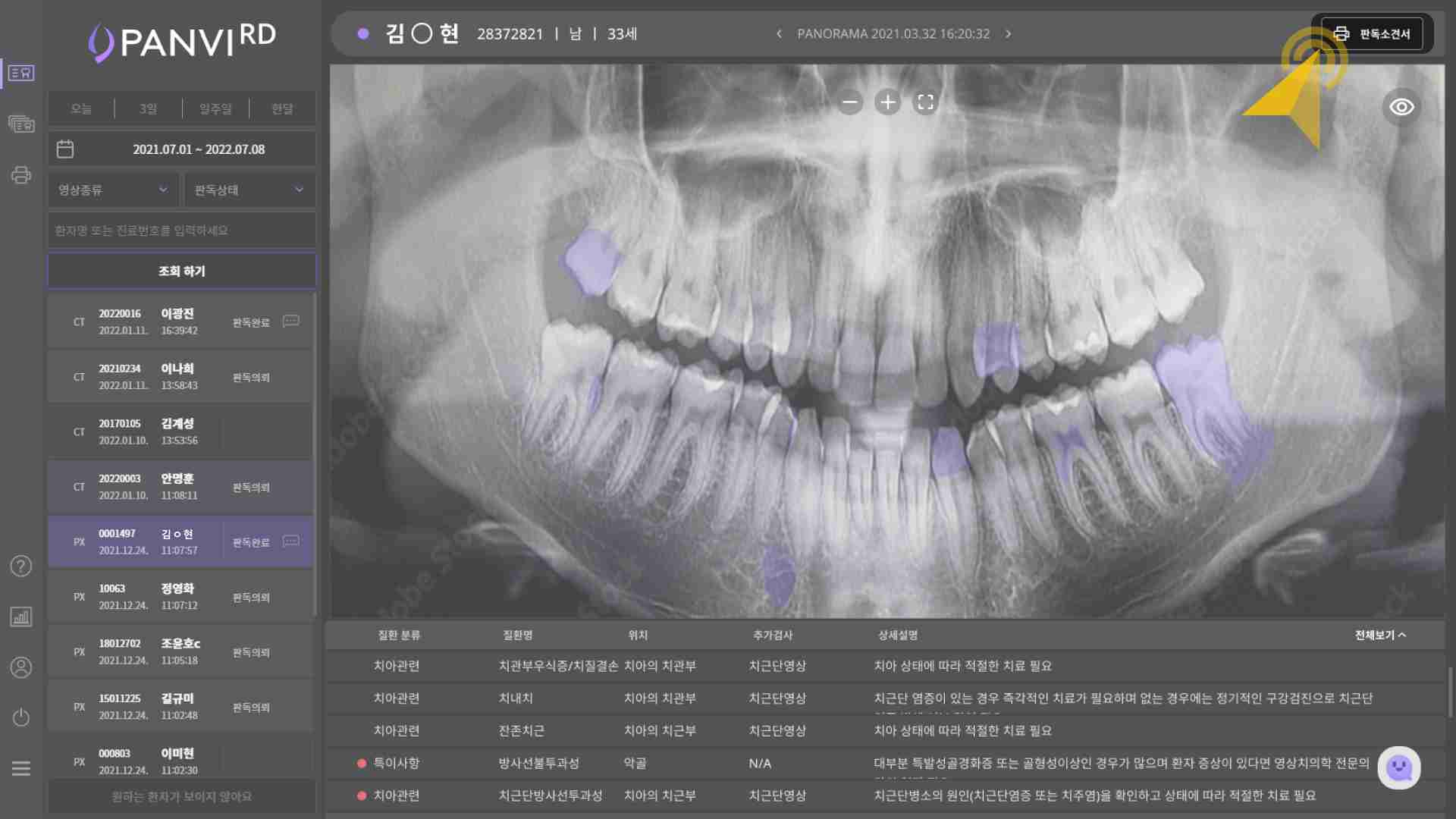 ‘판독소견서’ 버튼을 선택합니다.