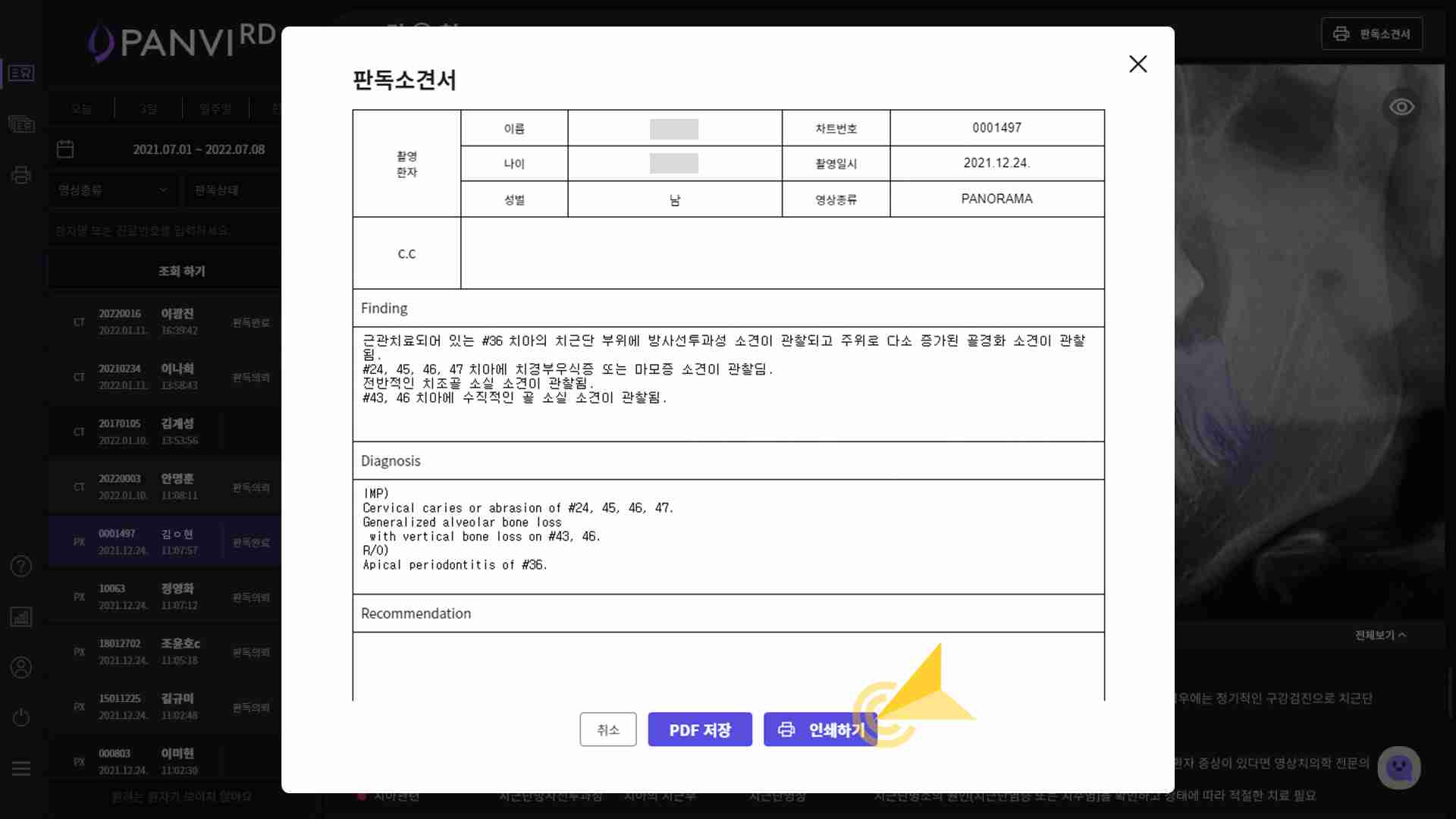 판독소견서를 확인하고 PDF파일로 다운로드하거나 인쇄합니다. 